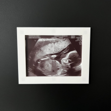 Fotorámeček Ultrazvuk miminka