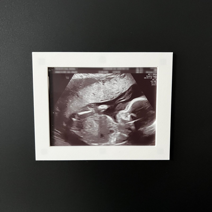 Fotorámeček Ultrazvuk miminka